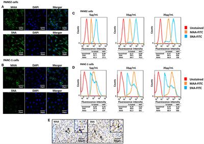 H5N1 Influenza a Virus Replicates Productively in Pancreatic Cells and Induces Apoptosis and Pro-Inflammatory Cytokine Response